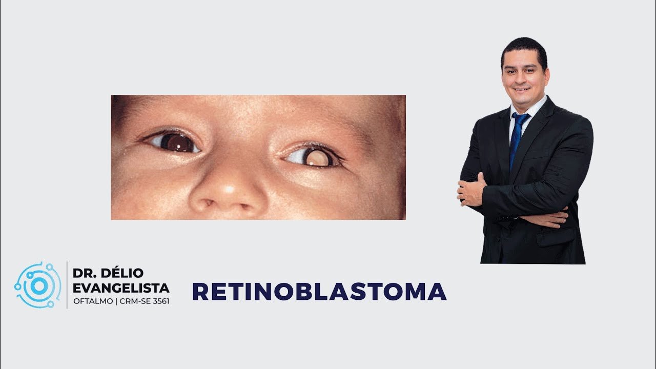 Dia Nacional de Conscientização do Retinoblastoma: Importância do Diagnóstico Precoce