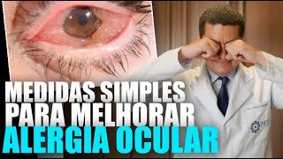 Medidas Simples para Controlar a Alergia Ocular em Casa