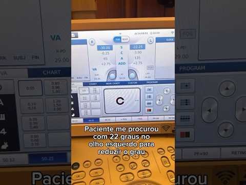 Qual o limite para correção de grau da cirurgia refrativa atual?
