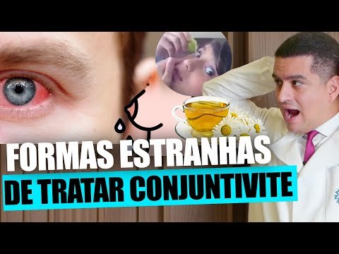 FORMAS ESTRANHAS DE TRATAR CONJUNTIVITE