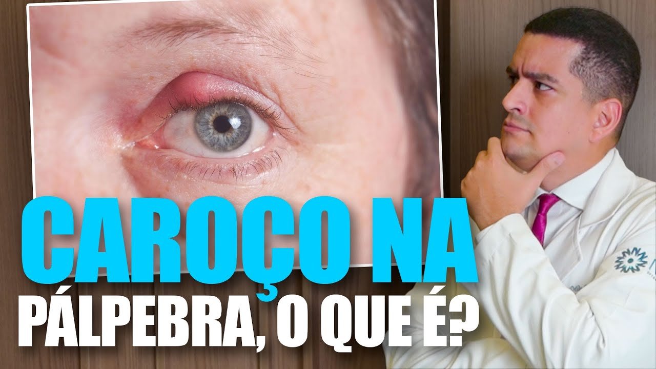 Caroço na Pálpebra, o que é?