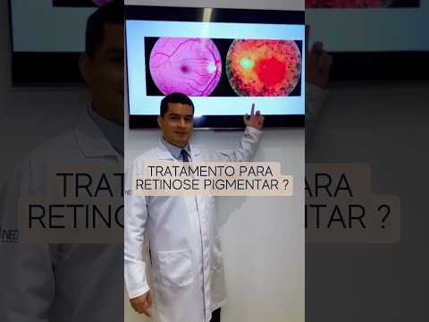 Primeiro tratamento para Retinose Pigmentar? #retinosepigmentar #terapiacelular #retina