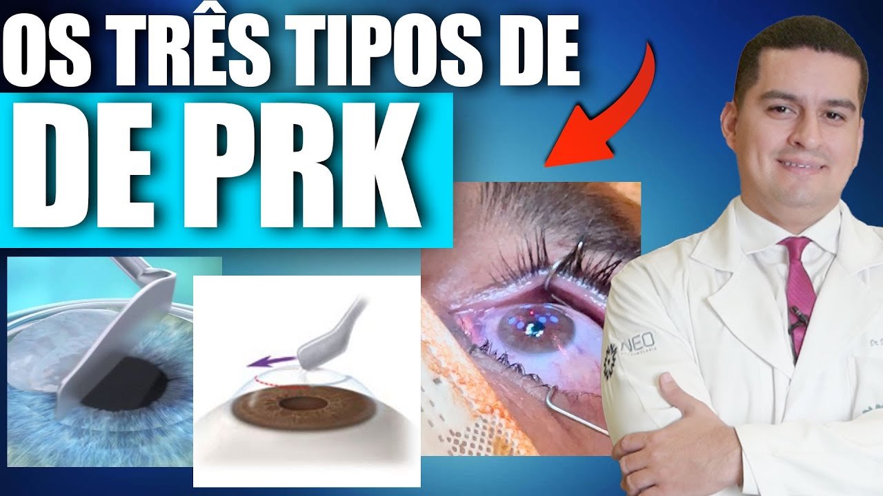 PRK: Entenda as Modalidades e Qual É a Mais Indicada para Você
