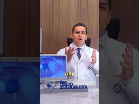 Comparativo da cirurgia de pterígio: ponto x cola