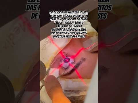 Cirurgia Refrativa 100% a laser tipo PRK para 8 graus de miopia de inscrita do canal q veio da Bahia