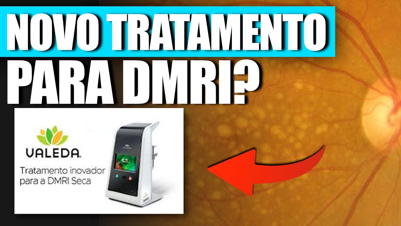 Fotobiomodulação: O Novo Tratamento para Degeneração Macular Relacionada à Idade (Forma Seca) Aprovado pelo FDA