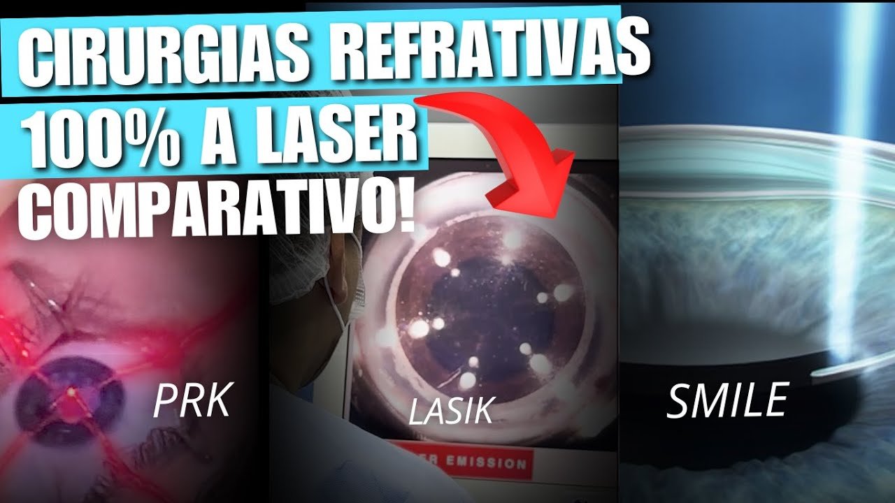Cirurgia para Astigmatismo: Quais as Melhores Opções?
