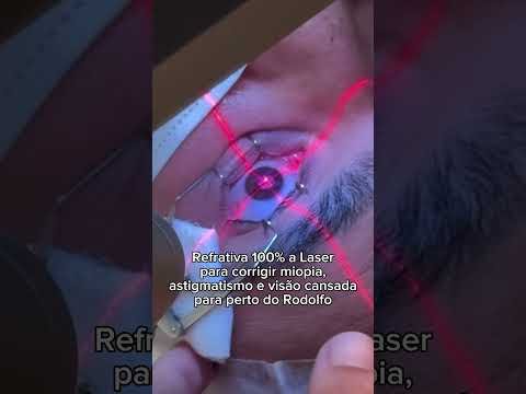 Cirurgia 100% a laser tipo PRK