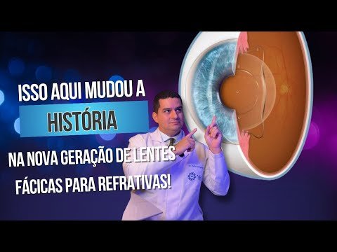 Isso aqui mudou a HISTÓRIA na nova geração de lentes fácicas para refrativas