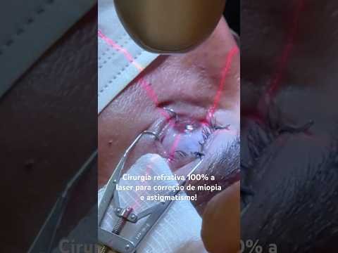 Cirurgia refrativa 100% a laser para correção de miopia e astigmatismo!