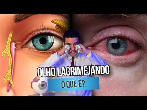 Olho lacrimejando, o que é?
