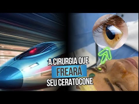 A cirurgia que freará seu ceratocone