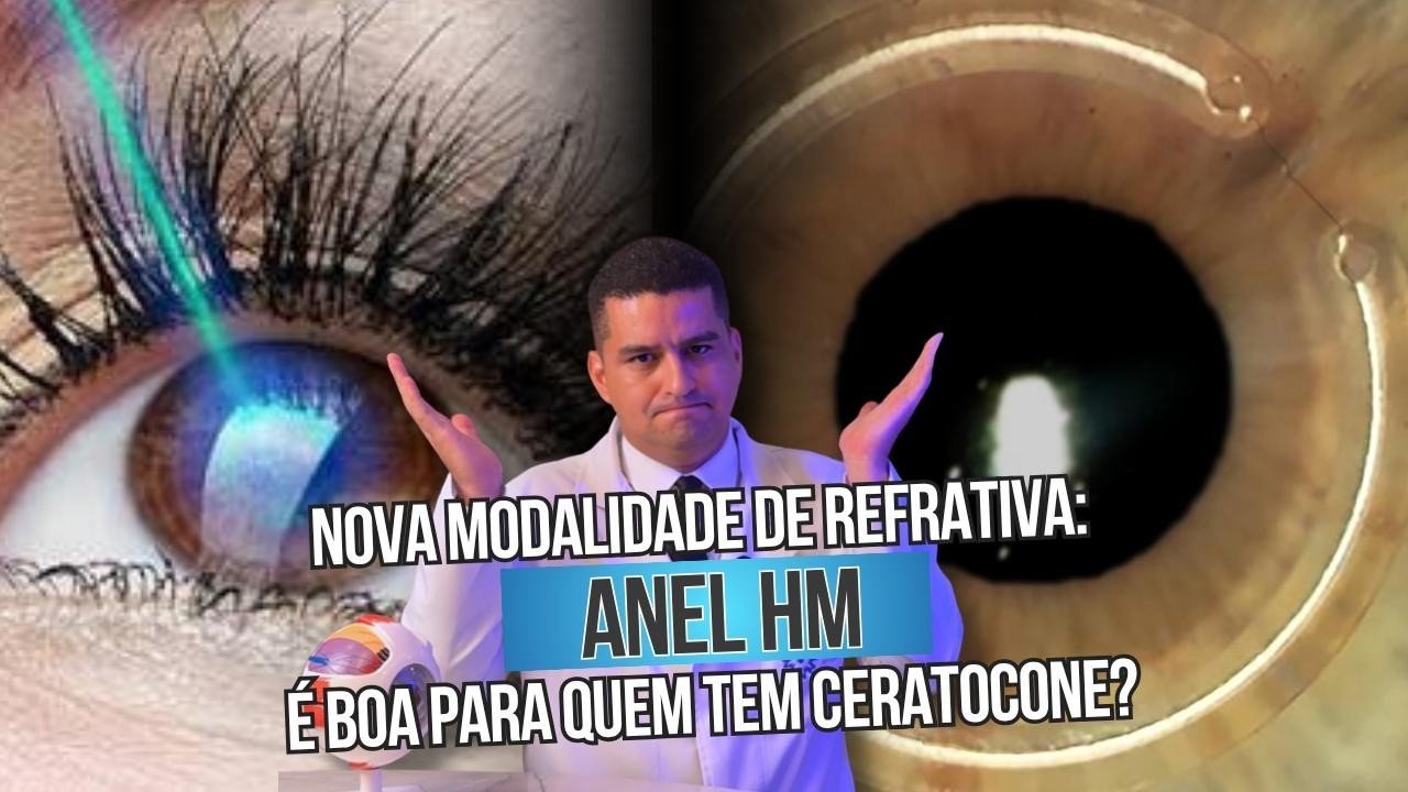 HM Ring: nova opção para quem tem ceratocone?