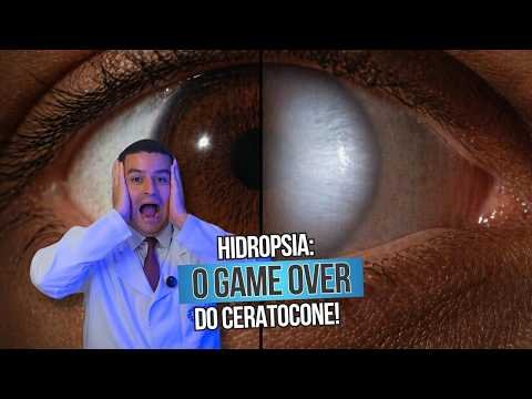 Hidropsia: o game over do ceratocone!