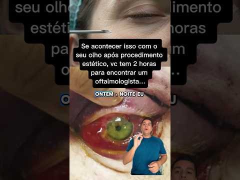 Hemorragia retrobulbar após procedimento estético